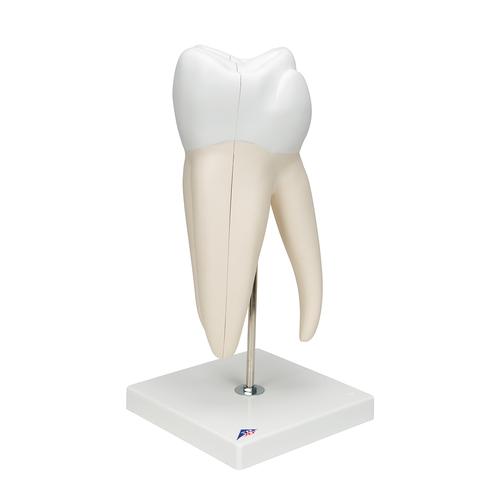 Giant Molar with Dental Cavities Human Tooth Model, 15 times Life-Size, 6 part, 1013215 [D15], Dental Models