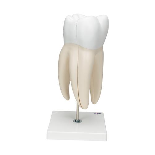 Giant Molar with Dental Cavities Human Tooth Model, 15 times Life-Size, 6 part, 1013215 [D15], Dental Models