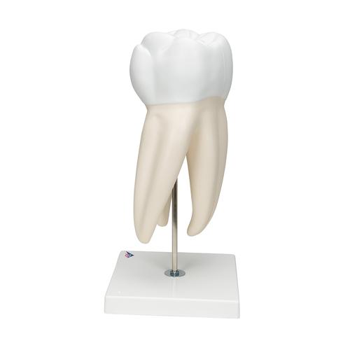 Giant Molar with Dental Cavities Human Tooth Model, 15 times Life-Size, 6 part, 1013215 [D15], Dental Models