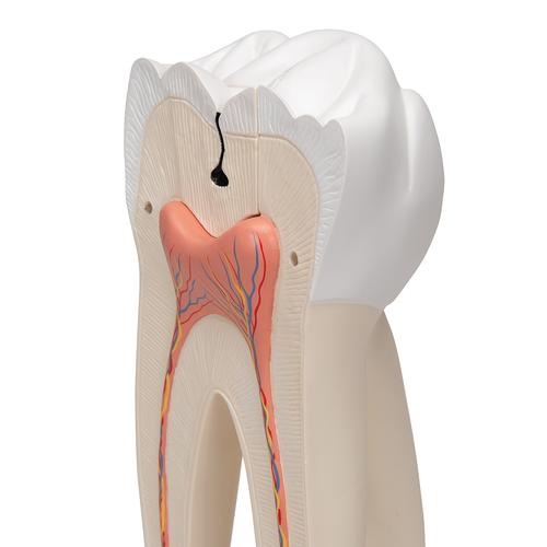 Dente molare superiore a tre radici, in 6 parti, 1013215 [D15], Modelli Dentali