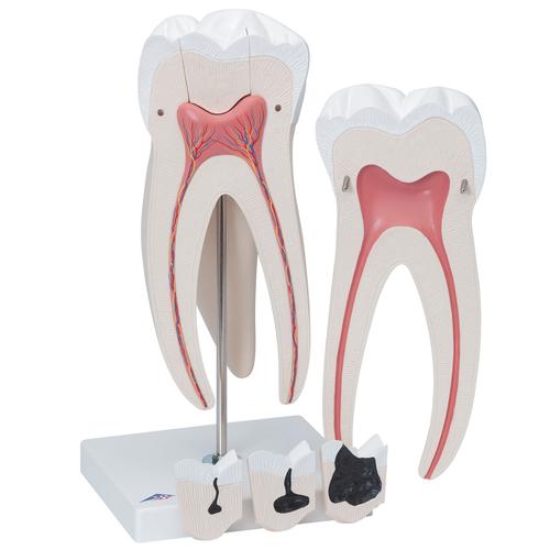 Dente molare superiore a tre radici, in 6 parti, 1013215 [D15], Modelli Dentali