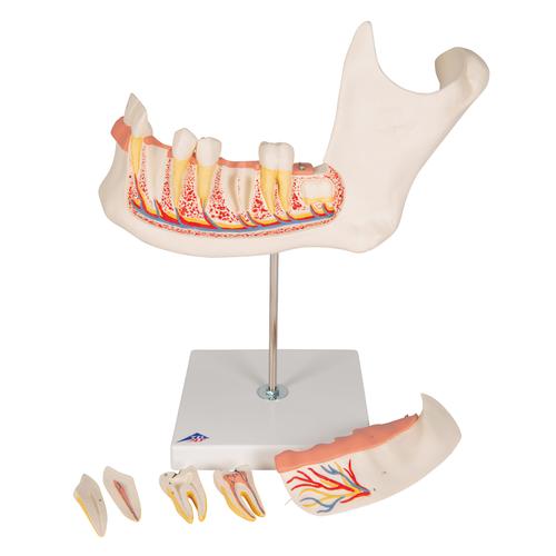 Modell eines halben Unterkiefers, 3-fache Größe, 6-teilig, 1000249 [D25], Zahnmodelle