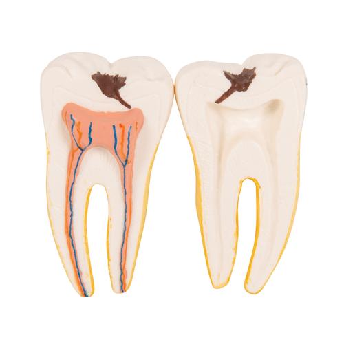 Half Lower Human Jaw Model, 3 times Full-Size, 6 part, 1000249 [D25], Dental Models