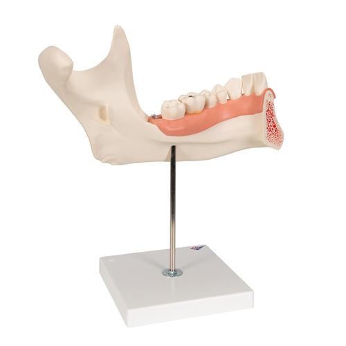 Half Lower Human Jaw Model, 3 times Full-Size, 6 part, 1000249 [D25], Dental Models