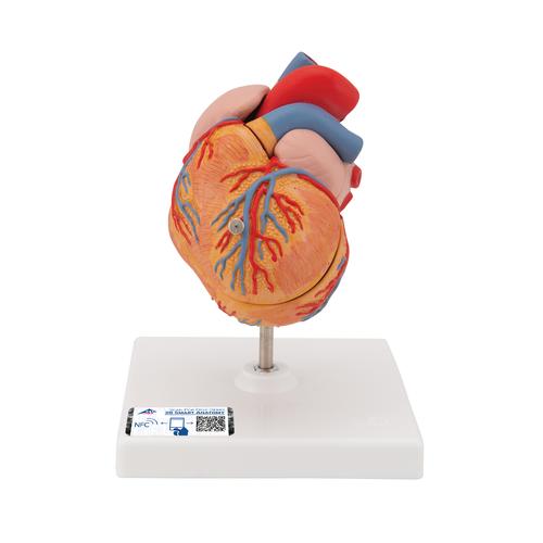 Classic Human Heart Model with Left Ventricular Hypertrophy (LVH), 2 part, 1000261 [G04], Human Heart Models