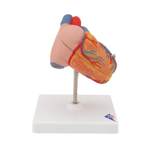 Classic Human Heart Model with Left Ventricular Hypertrophy (LVH), 2 part, 1000261 [G04], Human Heart Models