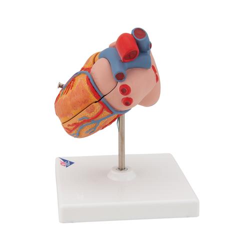 Classic Human Heart Model with Left Ventricular Hypertrophy (LVH), 2 part, 1000261 [G04], Human Heart Models