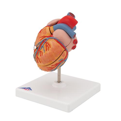 Cœur classique avec hypertrophie du ventricule gauche (HVG), en 2 parties, 1000261 [G04], Modèles cœur et circulation