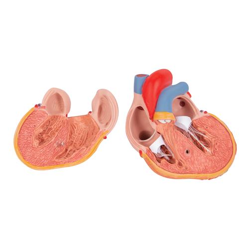 좌심실비대(LVH) 심장모형, 2-파트 Classic Heart with Left Ventricular Hypertrophy (LVH), 2 part, 1000261 [G04], 심장 및 순환기 모형