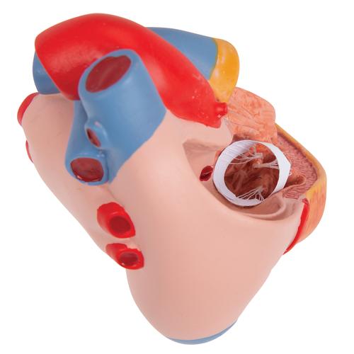 Classic Human Heart Model with Left Ventricular Hypertrophy (LVH), 2 part, 1000261 [G04], Human Heart Models