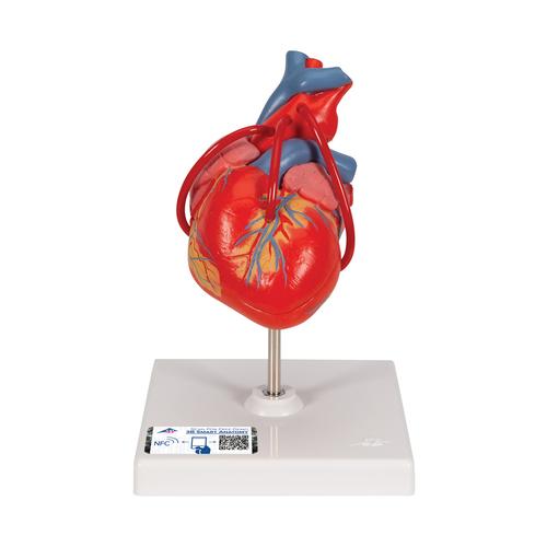 Cuore, modello classico, con bypass, in 2 parti, 1017837 [G05], Strumenti didattici cardiaci e di cardiofitness