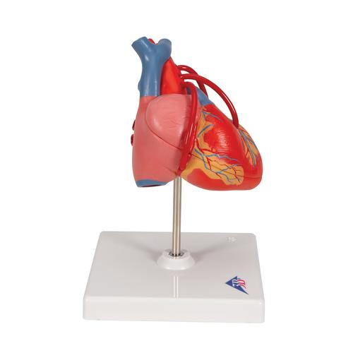 Classic Human Heart Model with Bypass, 2 part, 1017837 [G05], Heart Health and Fitness Education