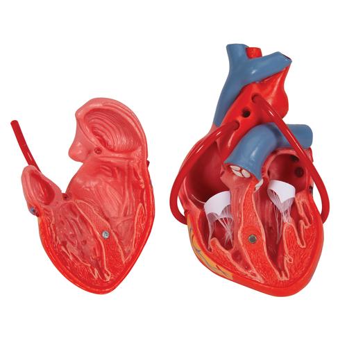 Cuore, modello classico, con bypass, in 2 parti, 1017837 [G05], Strumenti didattici cardiaci e di cardiofitness