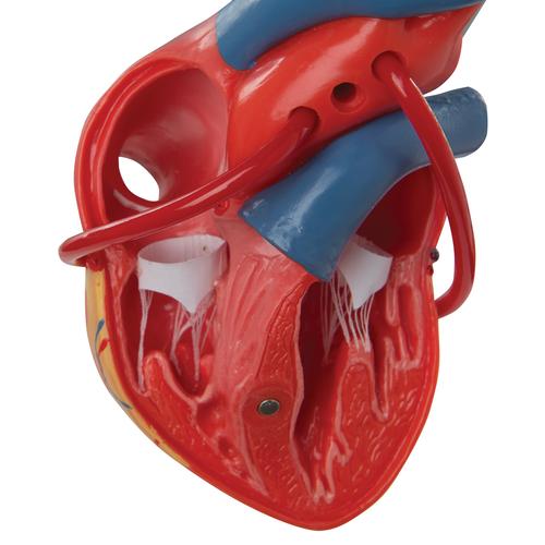 Cuore, modello classico, con bypass, in 2 parti, 1017837 [G05], Strumenti didattici cardiaci e di cardiofitness