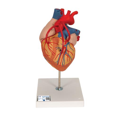 Human Heart Model with Bypass, 2 times Life-Size, 4 part, 1000263 [G06], Human Heart Models