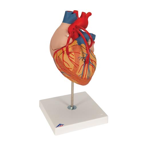 Human Heart Model with Bypass, 2 times Life-Size, 4 part, 1000263 [G06], Human Heart Models