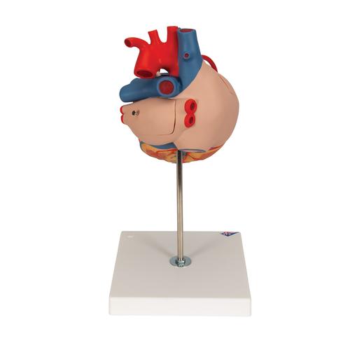 Human Heart Model with Bypass, 2 times Life-Size, 4 part, 1000263 [G06], Human Heart Models