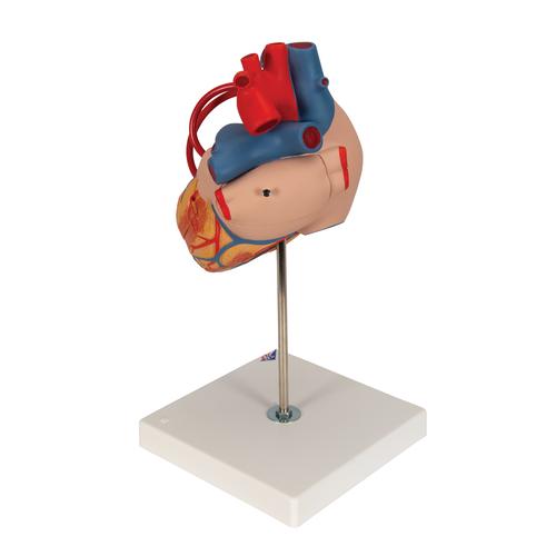 Human Heart Model with Bypass, 2 times Life-Size, 4 part, 1000263 [G06], Human Heart Models