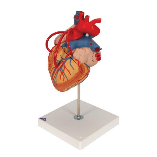 Human Heart Model with Bypass, 2 times Life-Size, 4 part, 1000263 [G06], Human Heart Models