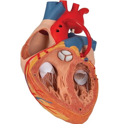 Cuore con bypass, ingrandito 2 volte, in 4 parti, 1000263 [G06], Modelli di Cuore e Apparato Circolatorio