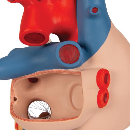 Human Heart Model with Bypass, 2 times Life-Size, 4 part, 1000263 [G06], Human Heart Models