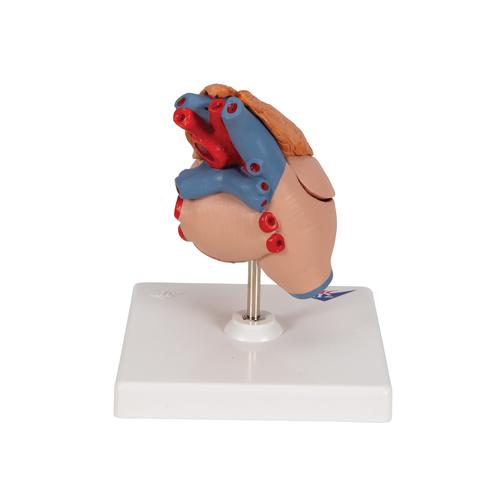 Classic Human Heart Model with Thymus, 3 part, 1000265 [G08/1], Human Heart Models