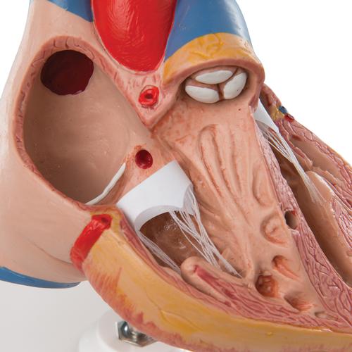 Classic Human Heart Model with Thymus, 3 part, 1000265 [G08/1], Human Heart Models