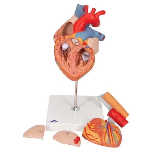 Human Heart Model with Esophagus and Trachea, 2 times Life-Size, 5 part, 1000269 [G13], Human Heart Models