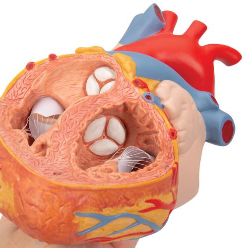 Human Heart Model with Esophagus and Trachea, 2 times Life-Size, 5 part, 1000269 [G13], Human Heart Models