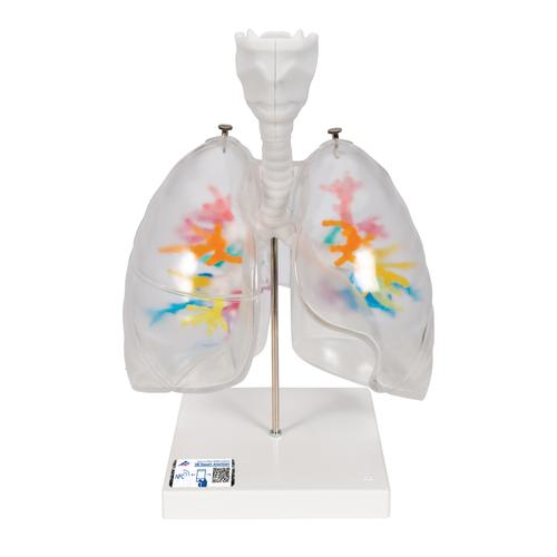 CT - Arbre bronchique avec larynx et poumon transparent, 1000275 [G23/1], Modèles de poumons