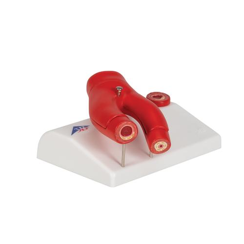 동맥경화증 모형 동맥의 횡단면 2파트 분리 Arteriosclerosis Model, with cross section of artery, 2 part, 1000278 [G40], 심장 및 순환기 모형