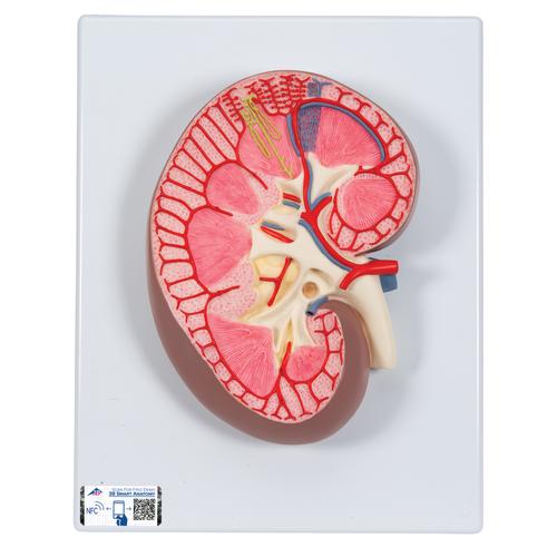 Kidney Section Model, 3 times Full-Size, 1000296 [K10], Urology Models