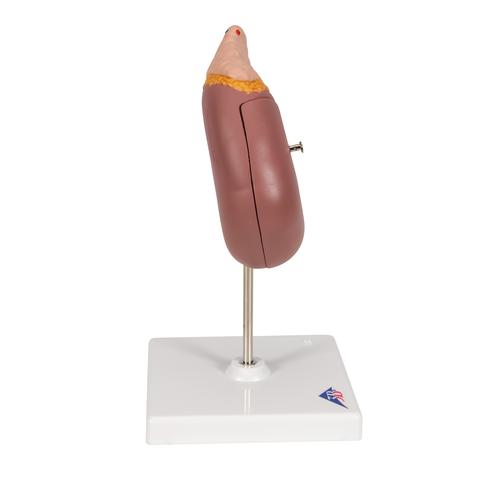 Kidney Model with Adrenal Gland, 2 part, 1014211 [K12], Urology Models