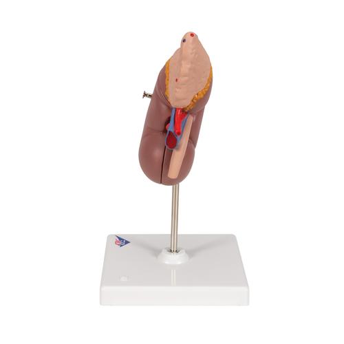 Kidney Model with Adrenal Gland, 2 part, 1014211 [K12], Urology Models