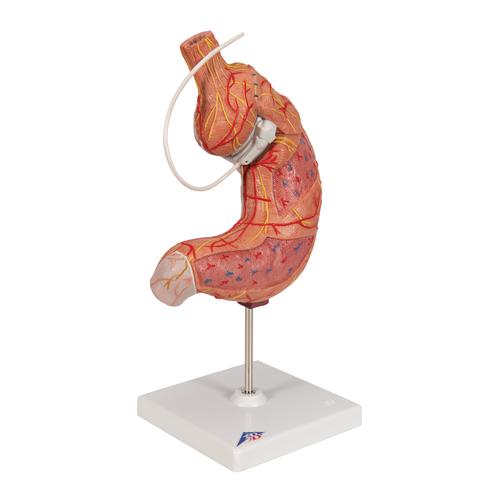 Human Stomach Model with Gastric Band, 2 part, 1012787 [K15/1], Digestive System Models