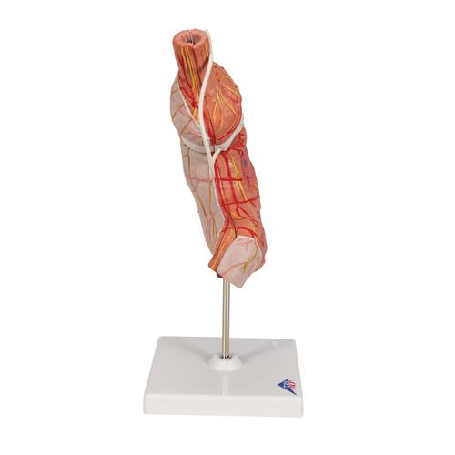 Human Stomach Model with Gastric Band, 2 part, 1012787 [K15/1], Digestive System Models