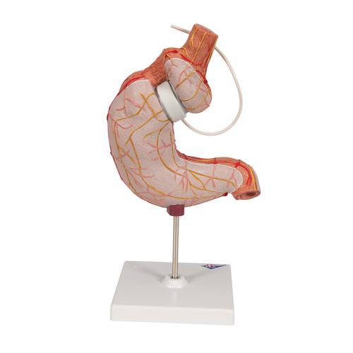 Human Stomach Model with Gastric Band, 2 part, 1012787 [K15/1], Digestive System Models