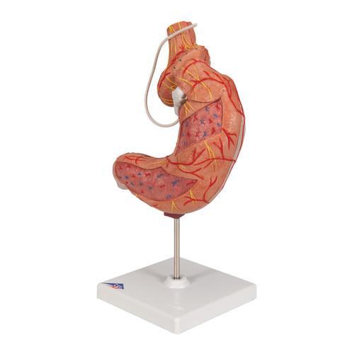 Human Stomach Model with Gastric Band, 2 part, 1012787 [K15/1], Digestive System Models