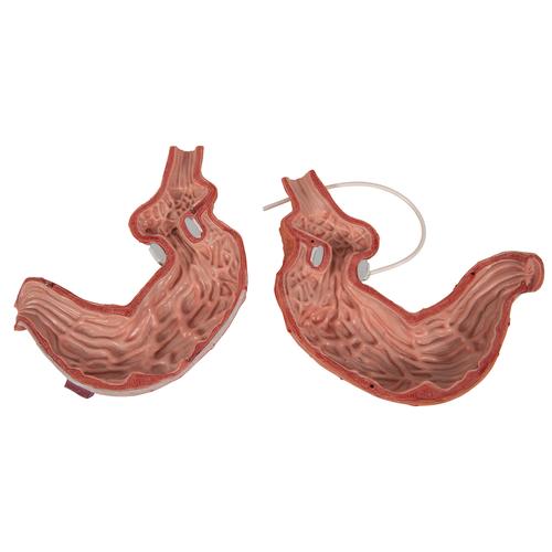 Human Stomach Model with Gastric Band, 2 part, 1012787 [K15/1], Digestive System Models