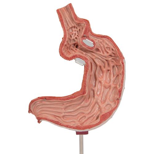 Human Stomach Model with Gastric Band, 2 part, 1012787 [K15/1], Digestive System Models