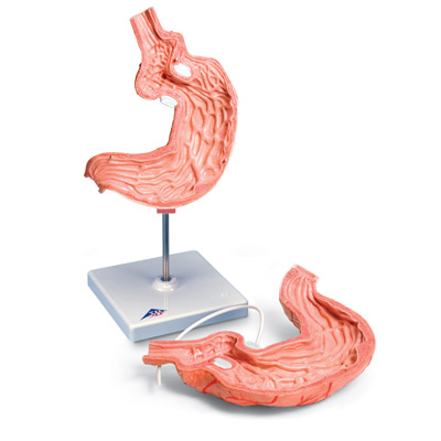 Human Stomach Model with Gastric Band, 2 part, 1012787 [K15/1], Digestive System Models