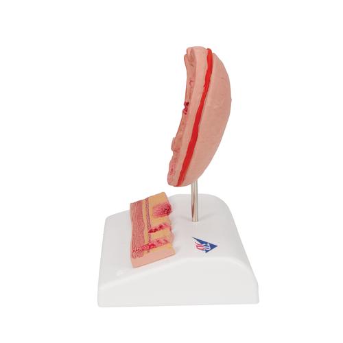 Human Stomach Section Model with Ulcers, 1000304 [K17], Digestive System Models