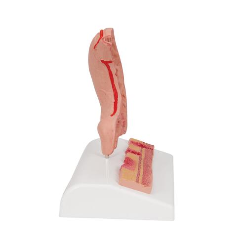 Estómago con úlceras gástricas, 1000304 [K17], Modelos del Sistema Digestivo