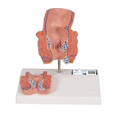 치질 모형

Hemorrhoid Model, 1000315 [K27], 소화기 모형