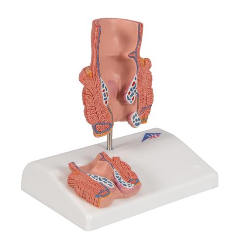 치질 모형

Hemorrhoid Model, 1000315 [K27], 소화기 모형