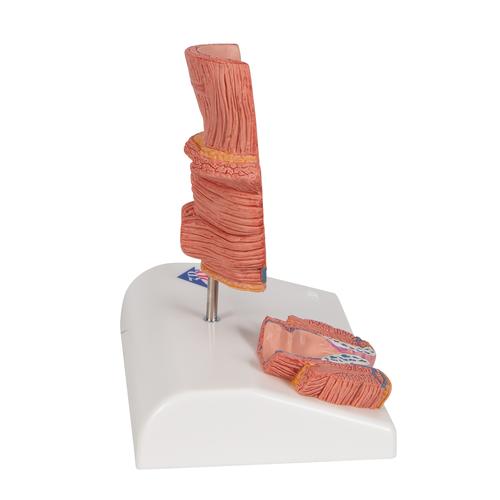 치질 모형

Hemorrhoid Model, 1000315 [K27], 소화기 모형