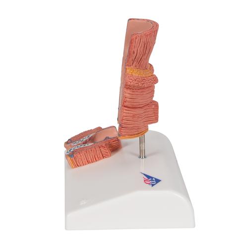 치질 모형

Hemorrhoid Model, 1000315 [K27], 소화기 모형