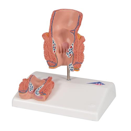 Hemorrhoid Model, 1000315 [K27], Digestive System Models