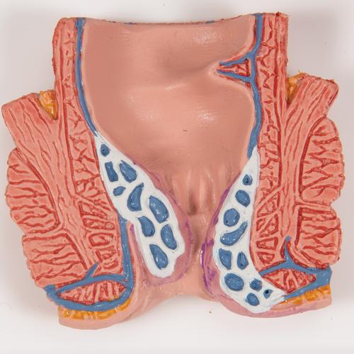 Hemorrhoid Model, 1000315 [K27], Digestive System Models