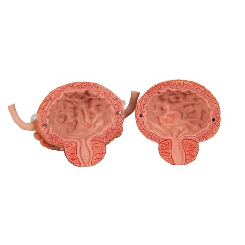 Dual Sex Urinary System Model, 6 part, 1000317 [K32], Urology Models